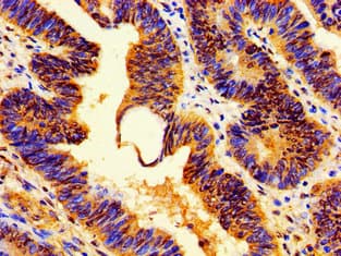 HIST1H1E Antibody