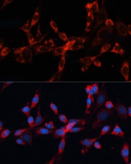 CTSL / Cathepsin L Antibody