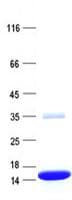 Human LOC391322 Protein (Recombinant His, N-Terminal)