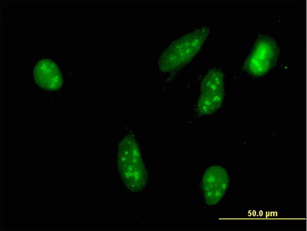 IHC-plus™ RPS6KA2 / RSK3 Antibody (clone 1F6)