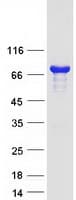 Human RCSD1 Protein (Recombinant Myc-DDK (Flag))
