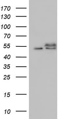 RAD23B / HR23B Antibody (aa1-253, clone OTI13A3)
