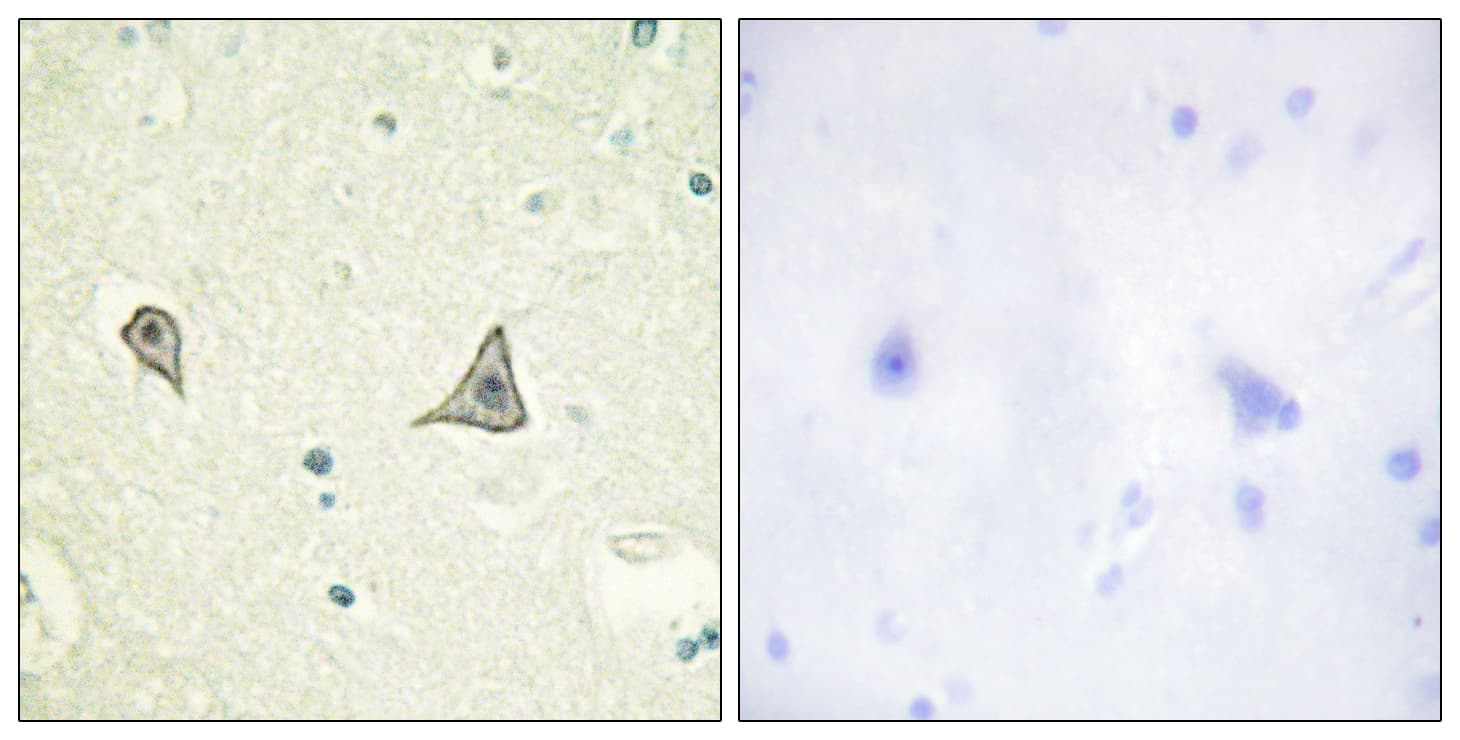 CSF1R / CD115 / FMS Antibody (aa691-740)