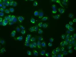 MSMB / MSP Antibody (clone OTI6C7, Carrier-free)