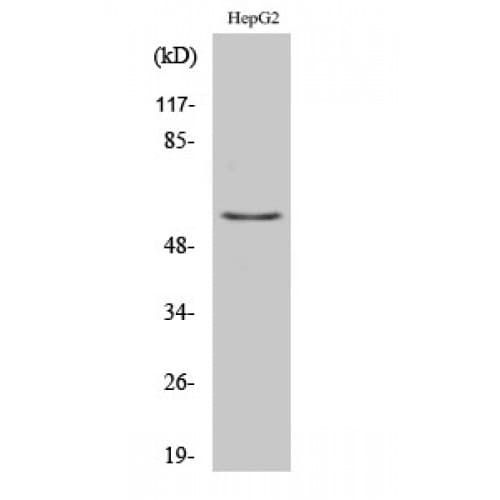 TH / Tyrosine Hydroxylase Antibody (10-90 aa)