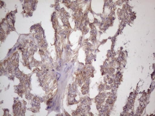 Monoclonal Mouse anti-Human BMF Antibody (clone OTI6F3, IHC, WB)