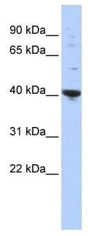 Polyclonal Rabbit anti-Human PURA / Pur-Alpha Antibody (aa35-84, WB)