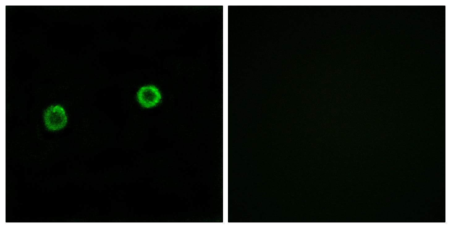 ACOT4 Antibody
