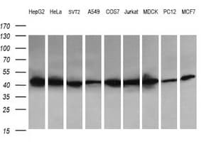 ACAA2 Antibody (clone OTI3C6)