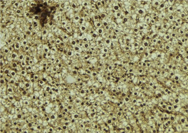 OTUD7B / Cezanne Antibody