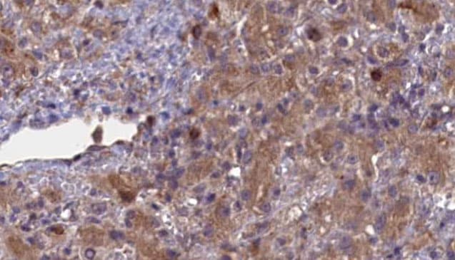 ABCG8 Antibody