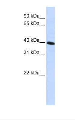 Polyclonal Rabbit anti-Human CARKD Antibody (aa144-193, WB)