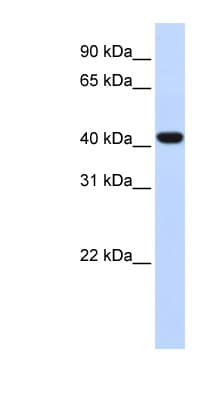 FOXD1 Antibody (aa324-373)