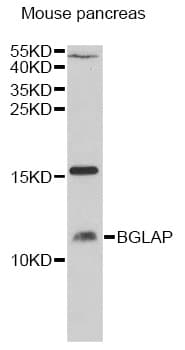 Polyclonal Rabbit anti-Human Osteocalcin Antibody (WB)