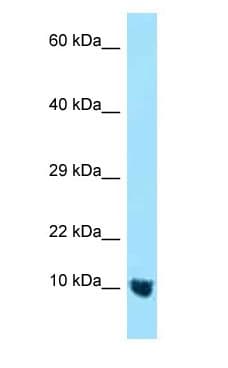MTCP1NB Antibody (C-Terminus)