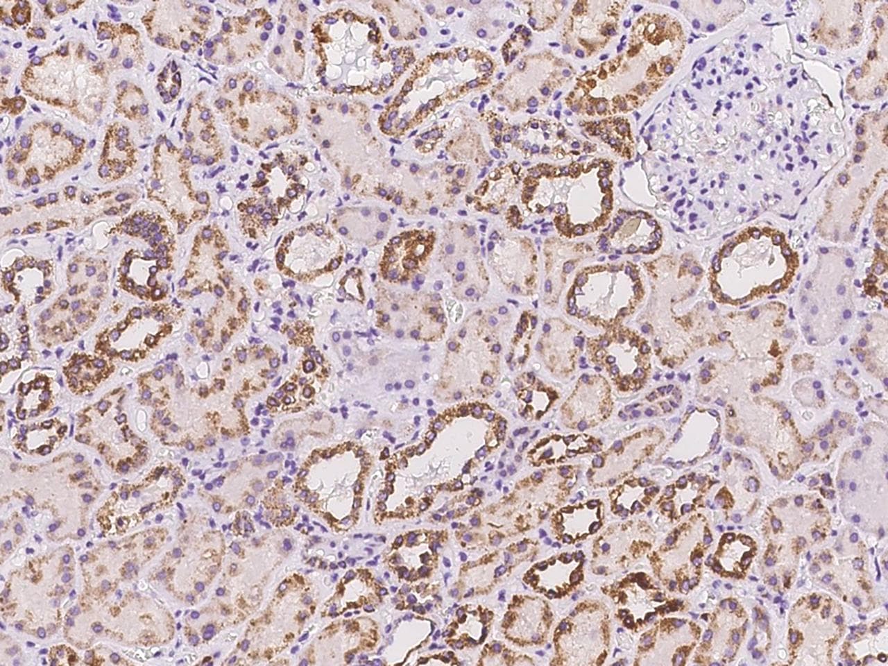 AMT Antibody