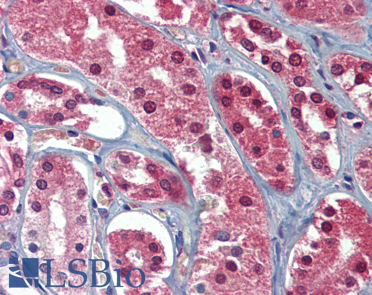 IHC-plus™ Polyclonal Rabbit anti-Human AAK1 Antibody (IHC, WB)