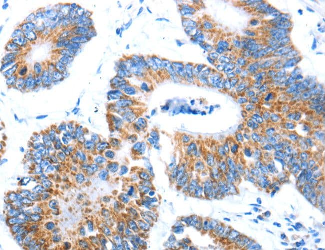 AIFM1 / AIF / PDCD8 Antibody