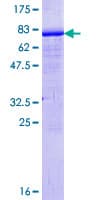 Human XRCC4 Protein (Recombinant GST)