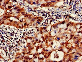 Polyclonal Rabbit anti-Human CAPN1 / Calpain 1 Antibody (IHC, WB)