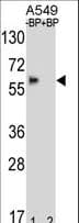 BBS4 Antibody (aa337-369)
