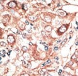 GJB2 / CX26 / Connexin 26 Antibody (aa204-226)