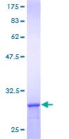 Human CCT8 Protein (Recombinant GST)