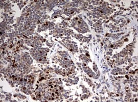TOP2A / Topoisomerase II Alpha Antibody (aa1100-1531, clone OTI2A9)
