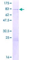 Human DDX28 Protein (Recombinant GST)