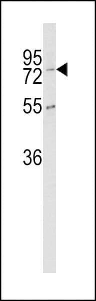 Carboxypeptidase Z / CPZ Antibody (aa143-172)