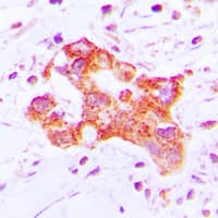 Polyclonal Rabbit anti-Human CYP39A1 Antibody (Internal, IHC, WB)