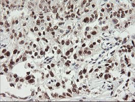 NUMB Antibody (clone OTI4F3, Carrier-free)