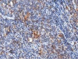 Monoclonal Mouse anti-Human ARHGAP25 Antibody (clone OTI11B9, IHC, IF, WB)