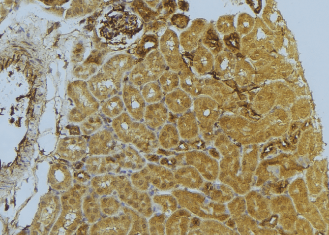 Polyclonal Rabbit anti-Human D2HGDH Antibody (IHC, WB)
