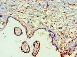SMAD9 Antibody (aa1-300)