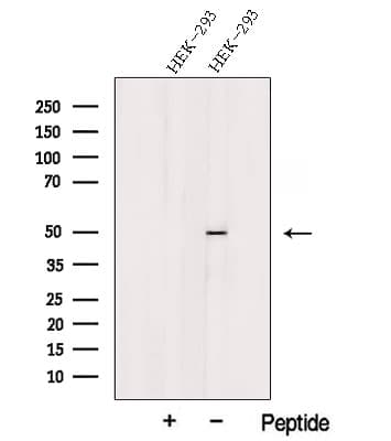 PRSS50 / TSP50 Antibody
