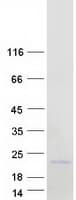 Human NANOS2 / NOS2 Protein (Recombinant Myc-DDK (Flag))