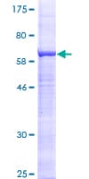 Human ST3GAL5 / GM3 Synthase Protein (Recombinant GST)