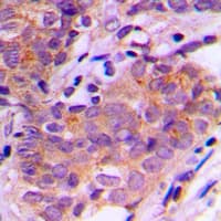 SGK1 / SGK Antibody (Internal)