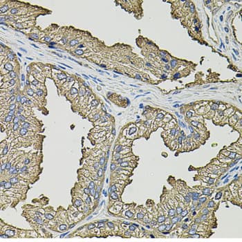 Polyclonal Rabbit anti-Human SMN2 Antibody (IHC, IF, WB)