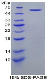 Mouse HSPD1 / HSP60 Protein (Recombinant His-T7)