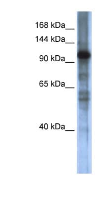 Polyclonal Rabbit anti-Human SMARCAL1 Antibody (aa719-768, WB)