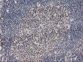 Monoclonal Mouse anti-Human MGLL / Monoacylglycerol Lipase Antibody (clone OTI1H1, IHC, IF, WB)