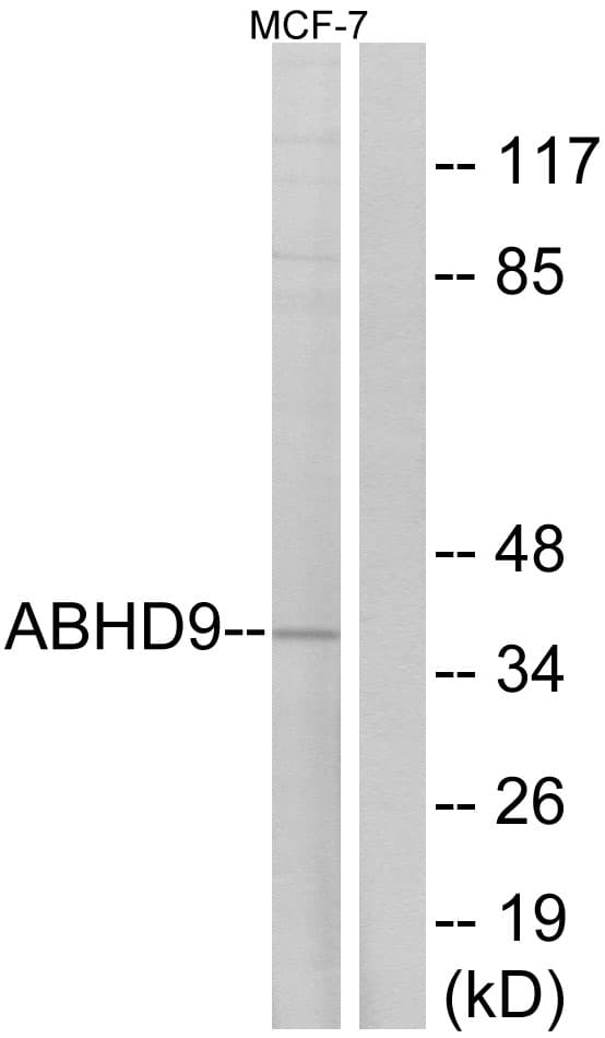 EPHX3 / Epoxide Hydrolase 3 Antibody (aa101-150)