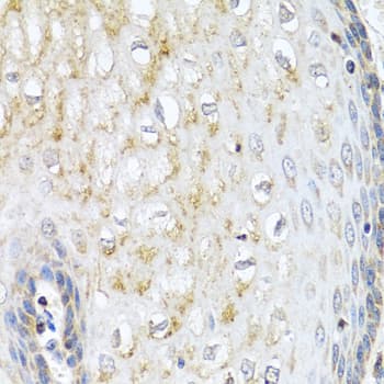 NMU / Neuromedin U Antibody