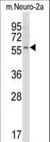 ACTRIIB / ACVR2B Antibody (aa148-176)