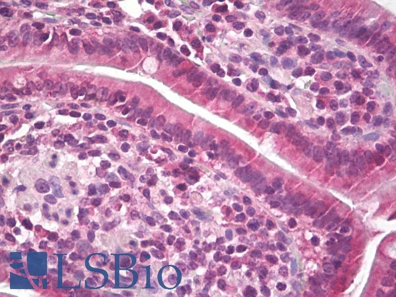 IHC-plus™ Polyclonal Rabbit anti-Human Endostatin Antibody (IHC, WB)