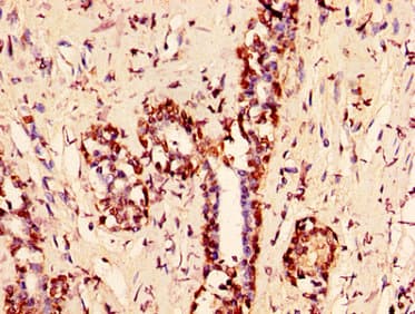 HIST1H1C Antibody