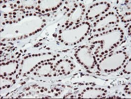 FMR1 / FMRP Antibody (clone OTI1C6)