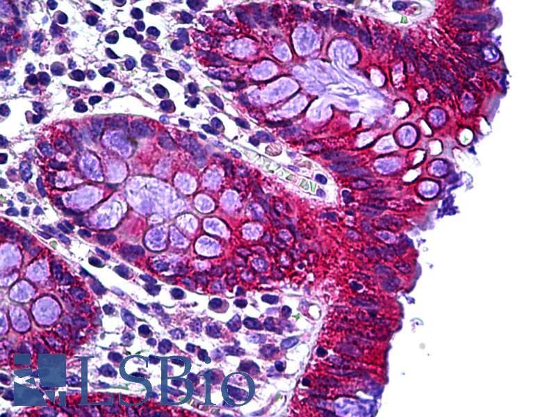 IHC-plus™ TTF / RHOH Antibody (aa141-190)